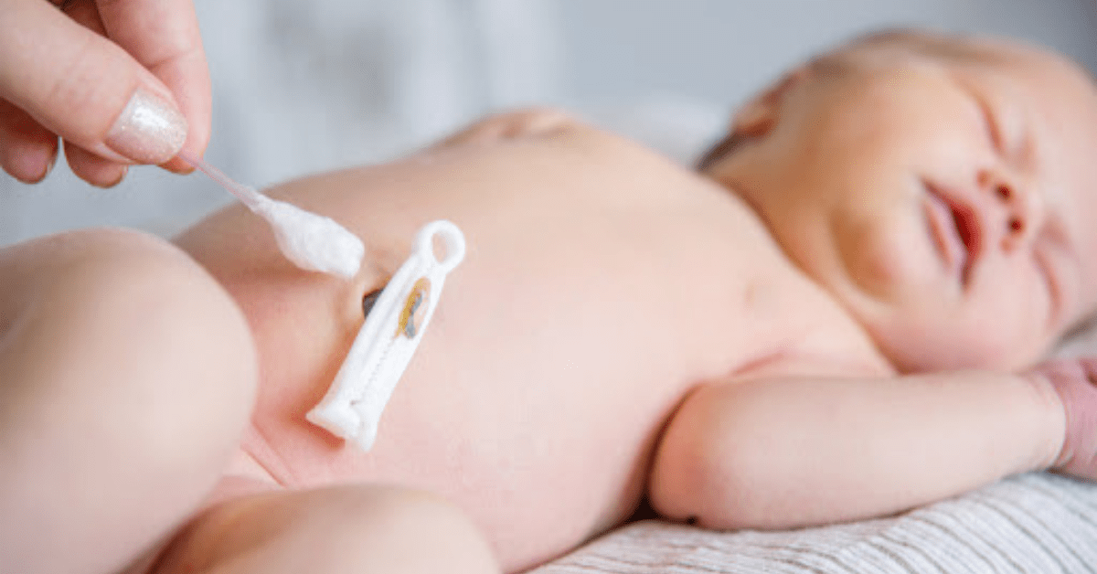Maternidade - Limpeza do cordão umbilical